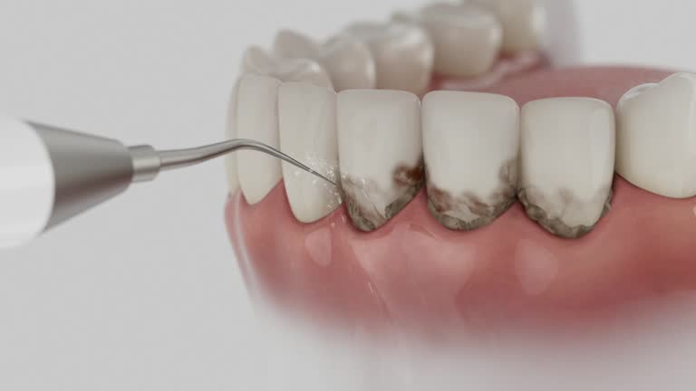 Reliable Emergency Dentist contractor in Clewiston, FL by Smile Center Dentistry